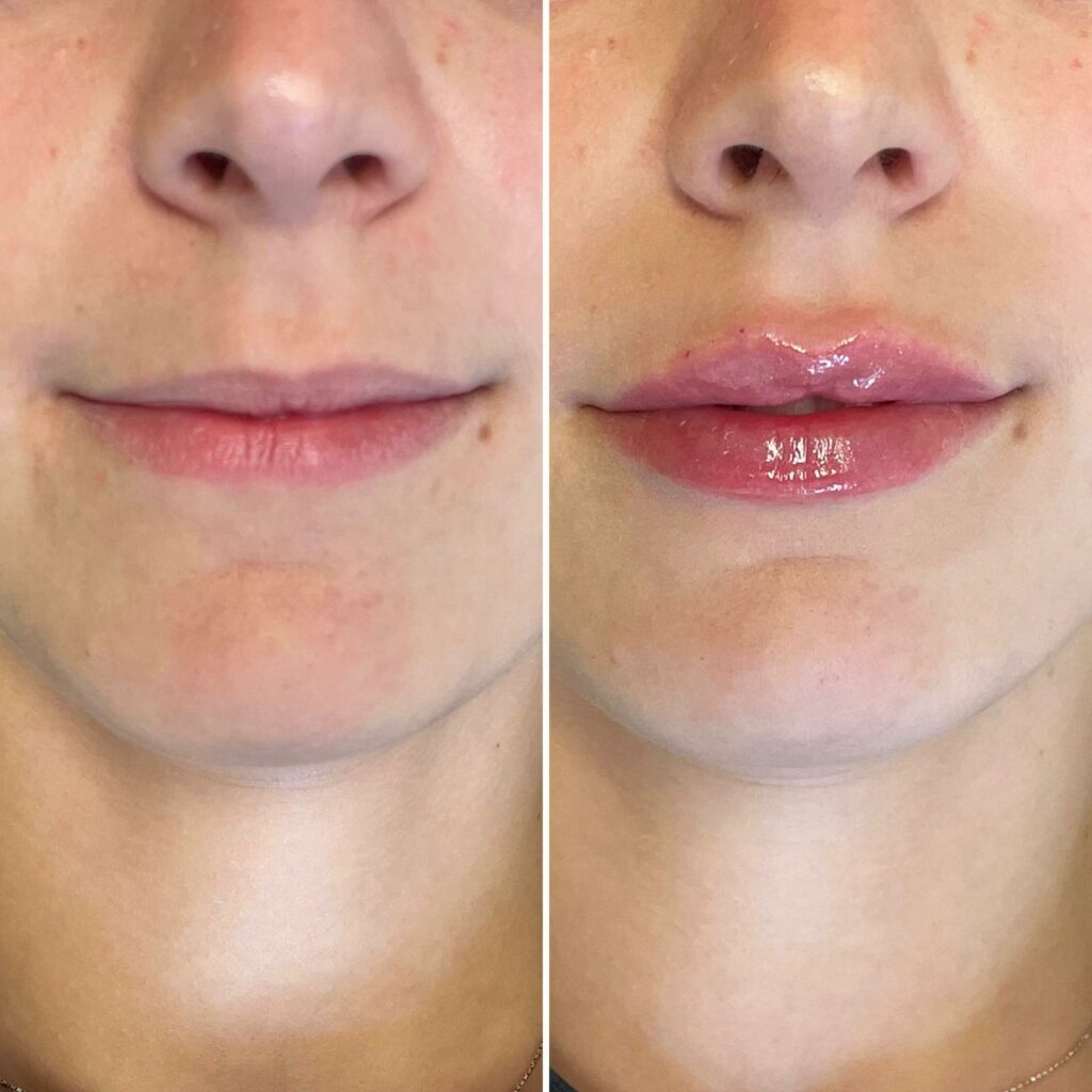 FOTO MEDICINA ESTETICA (1)