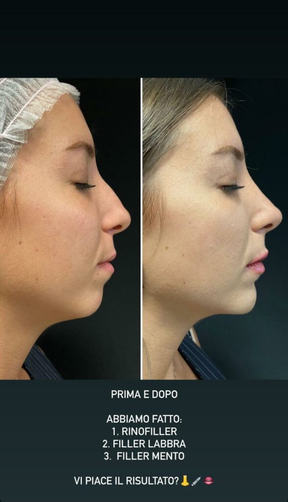 FOTO MEDICINA ESTETICA 2