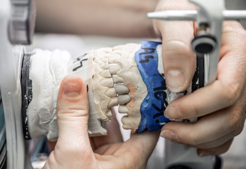 implantologia guidata