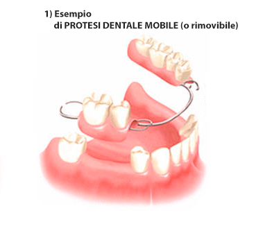 protesi-mobile-1