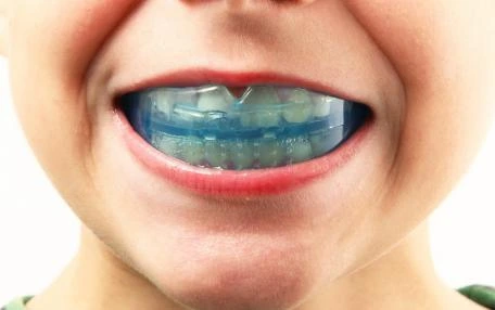 Bioattivatori ortodontici