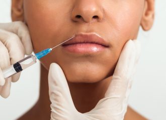 filler injection